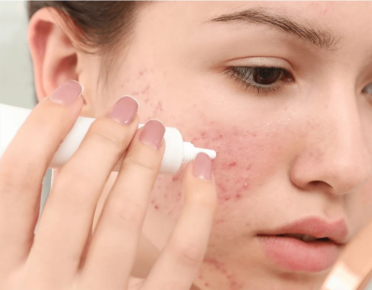 پماد آداپالن