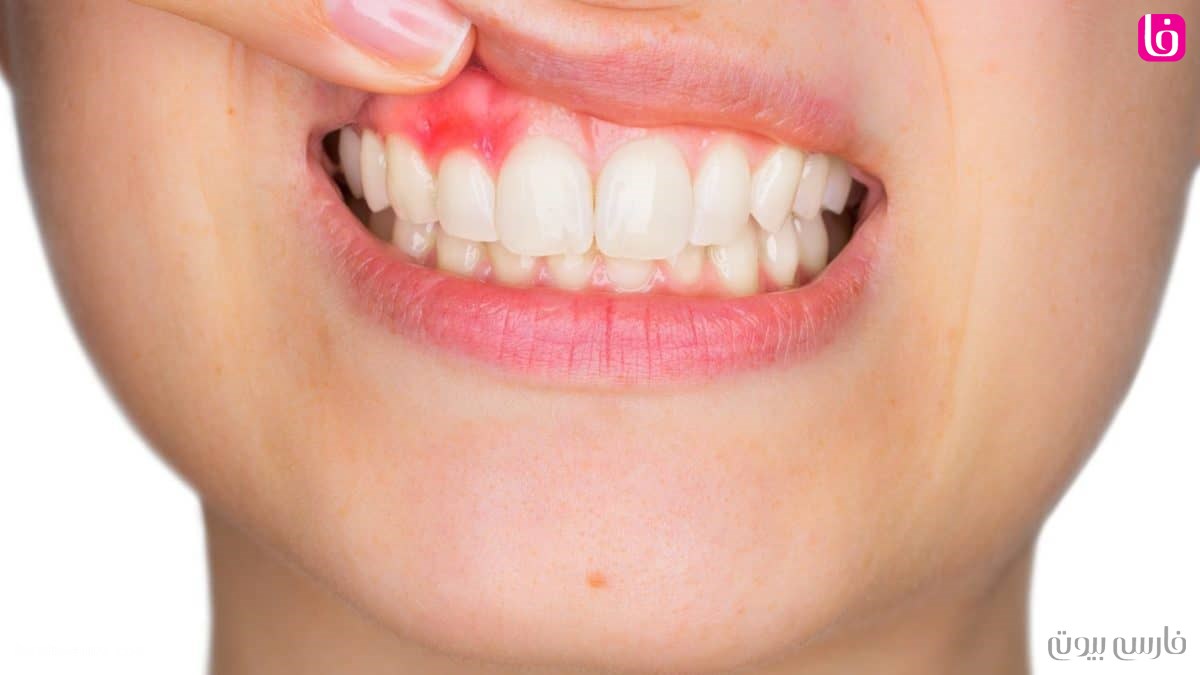 عفونت و آبسه دندان